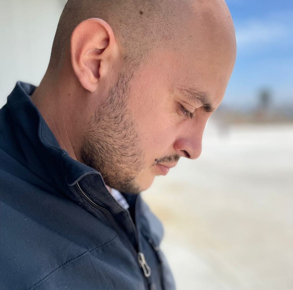 Equipo de J&J DS o imagen representativa